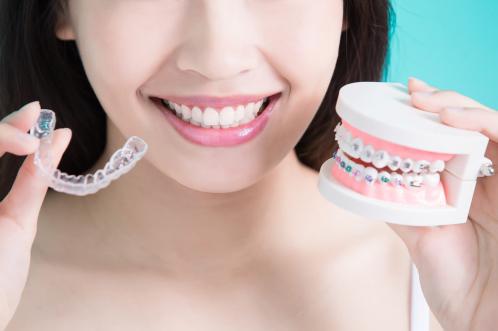 Does Invisalign Have Payment Plans