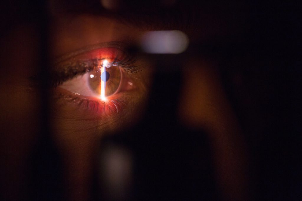  Lazy eye Surgery Costs