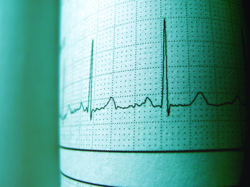 How much does an EKG cost?