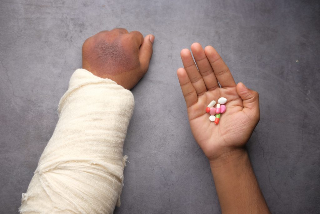 Broken Wrist Surgery Cost