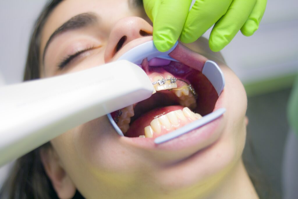 Shaving Teeth Cost